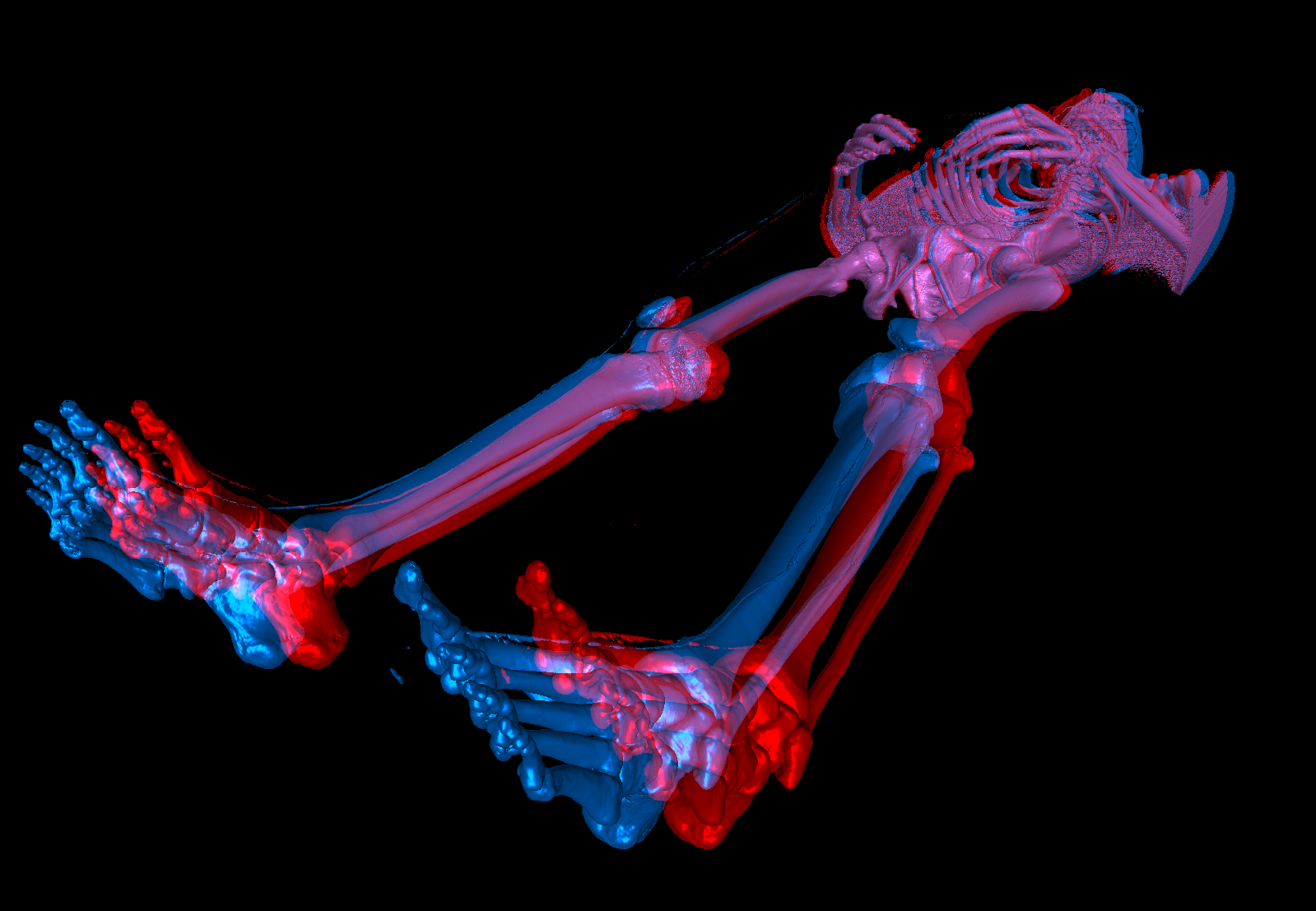  An anaglyph image of a human body rendered with ImageVis3D.