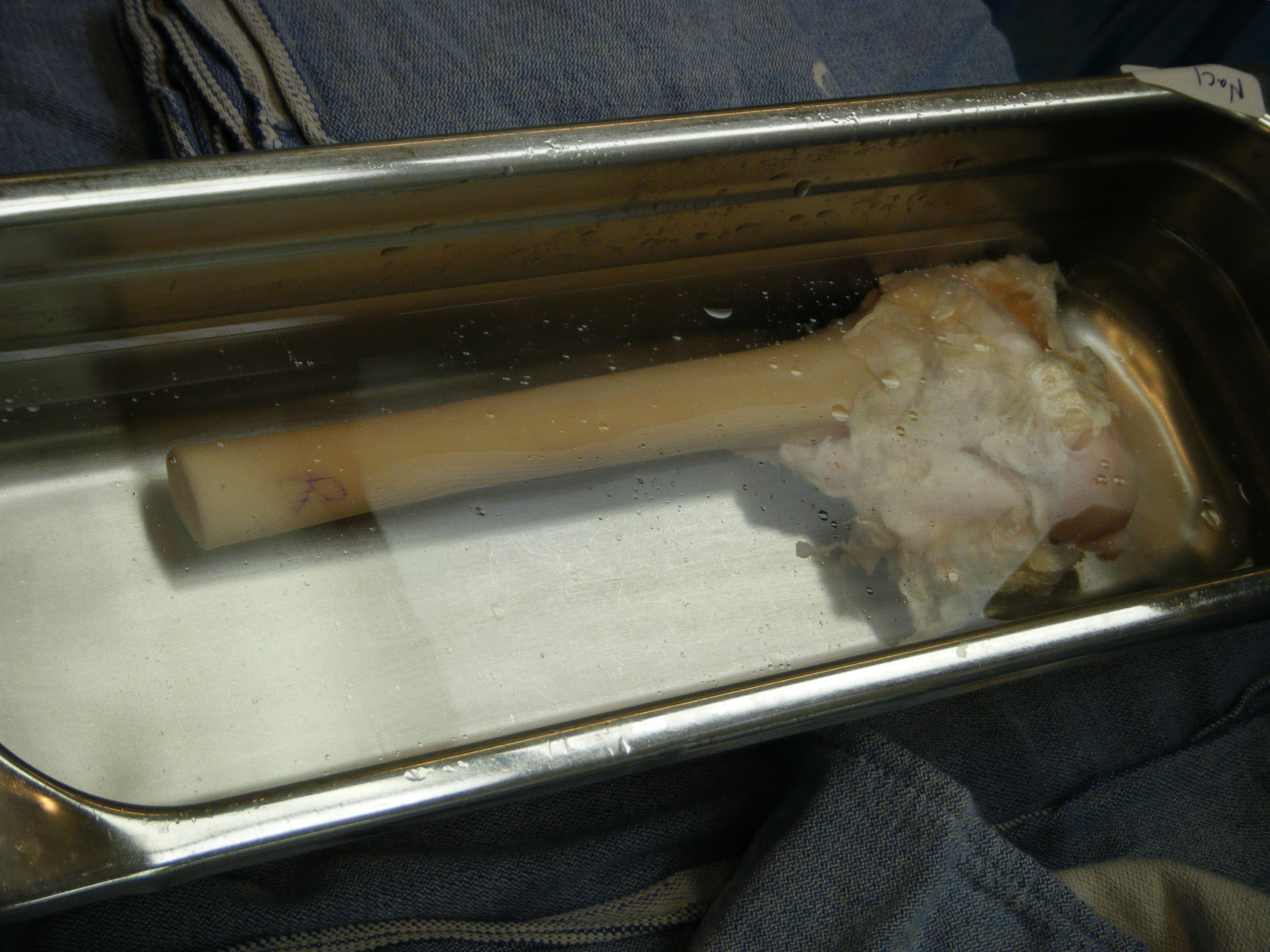 An allograft with tissue on the upper portion, the tissue is kept for adults that have a slower cell regeneration and is removed for young adults. An allograft with tissue on the upper portion, the tissue is kept for adults that have a slower cell regeneration and is removed for young adults.