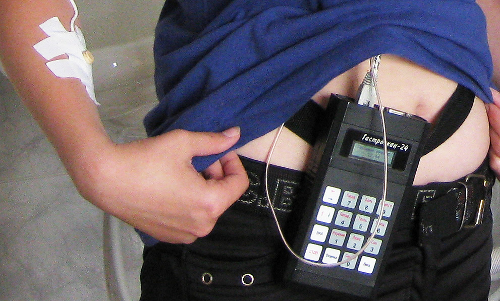 Used GastroScan-24 for 24-h or 48-h pH monitoring