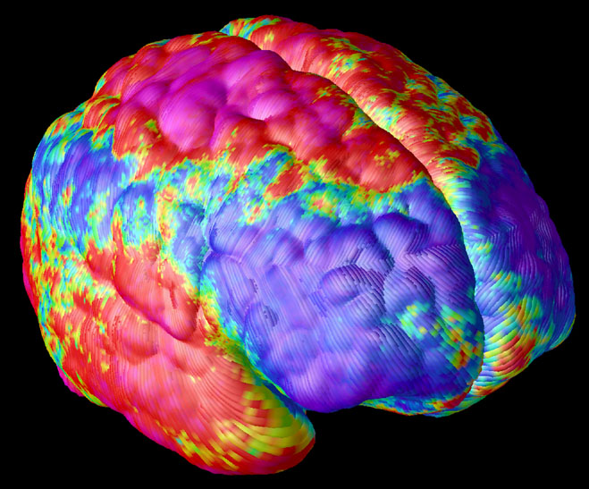 Schizophrenic Brain