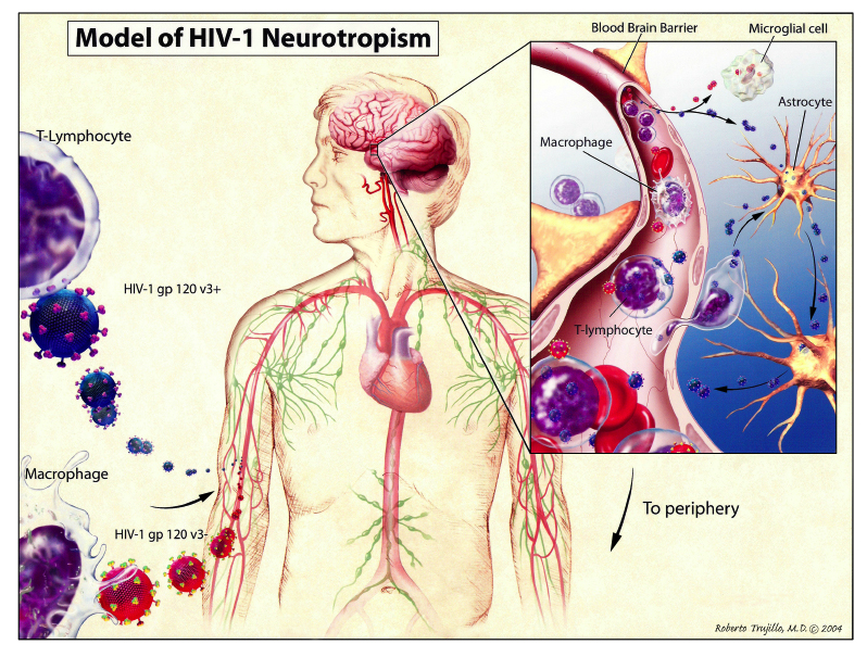 Model of HIV-1 Neurotropism