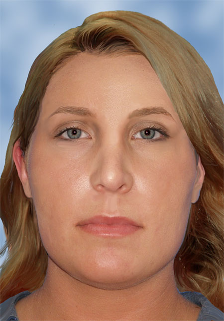 The Jane Doe found in Detroit in 2009