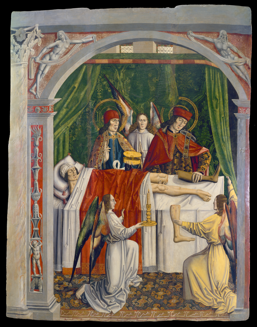 Saints Cosmas and Damian performing a miraculous cure by transplantation of a leg. Oil painting attributed to the Master of Los Balbases, ca. 1495. Saints Cosmas and Damian performing a miraculous cure by transplantation of a leg. Oil painting attributed to the Master of Los Balbases, ca. 1495.